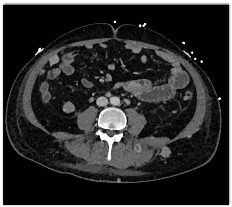 CTisus Quiz