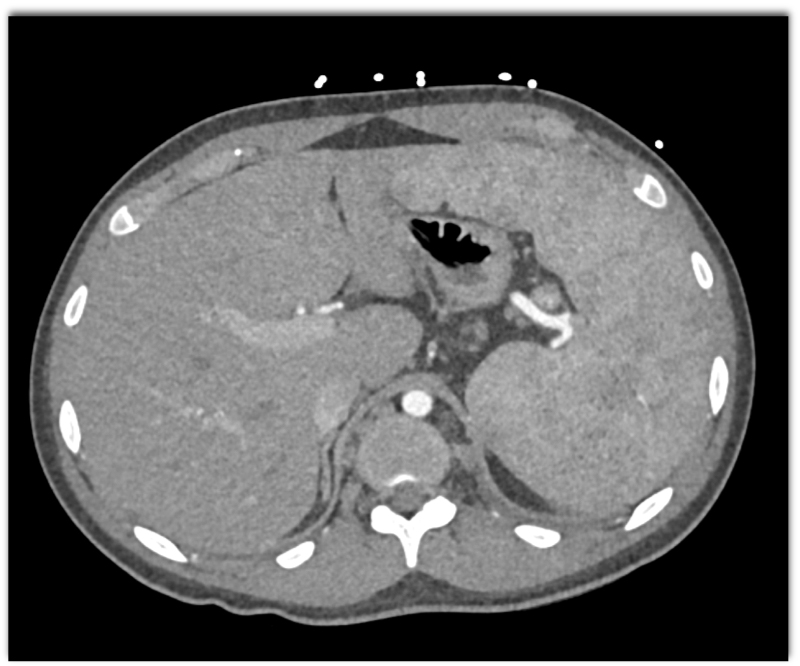 CTisus Quiz