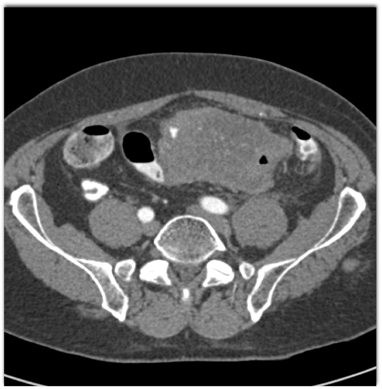 CTisus Quiz