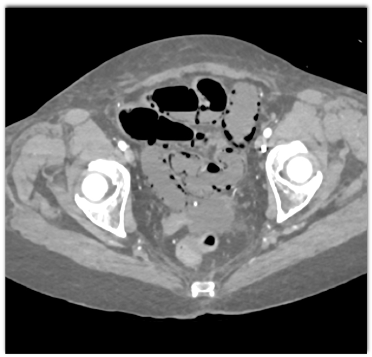 CTisus Quiz