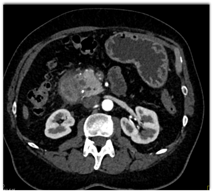 CTisus Quiz