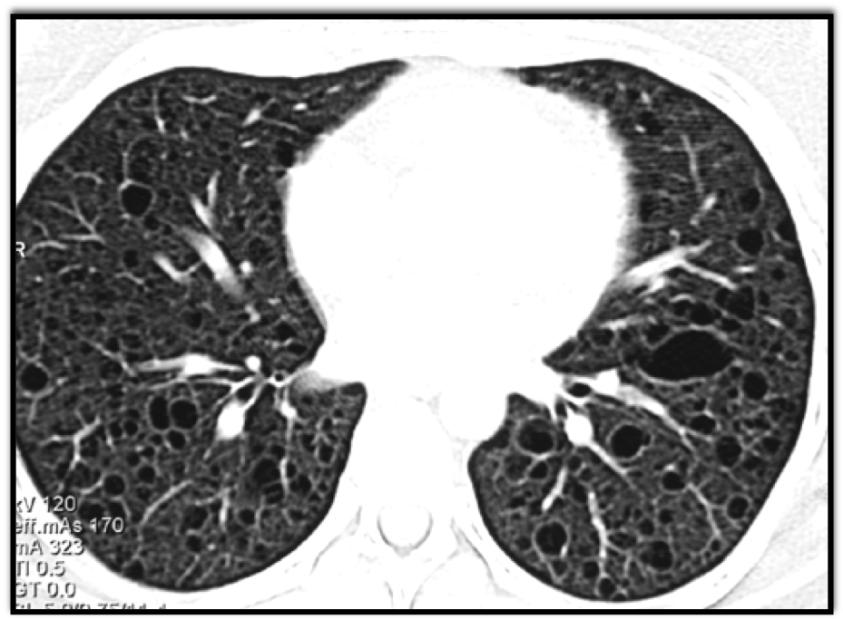 CTisus Quiz