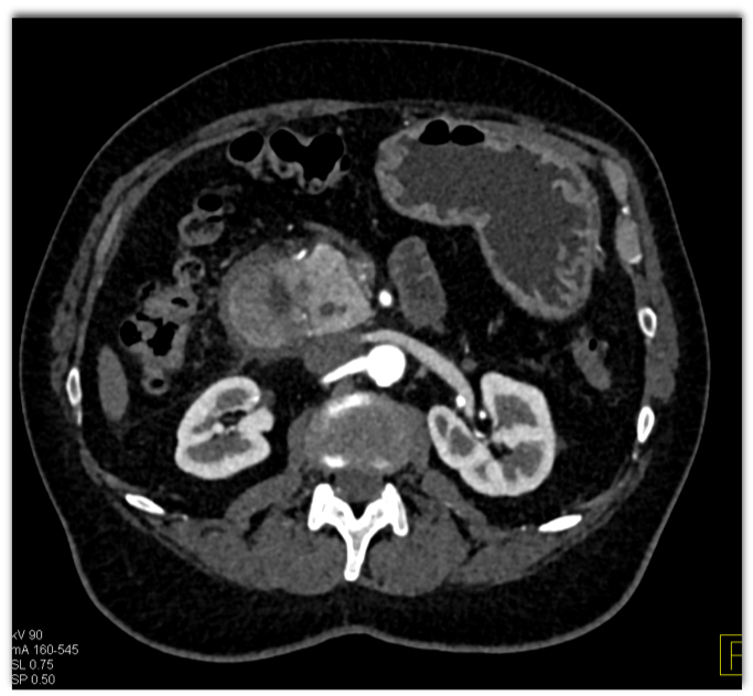 CTisus Quiz