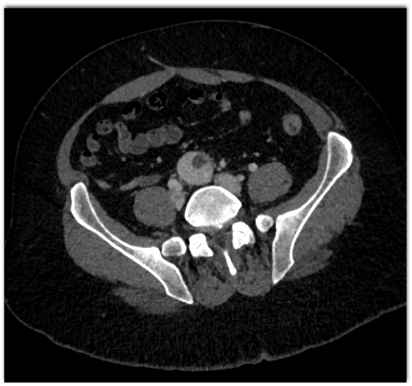 CTisus Quiz