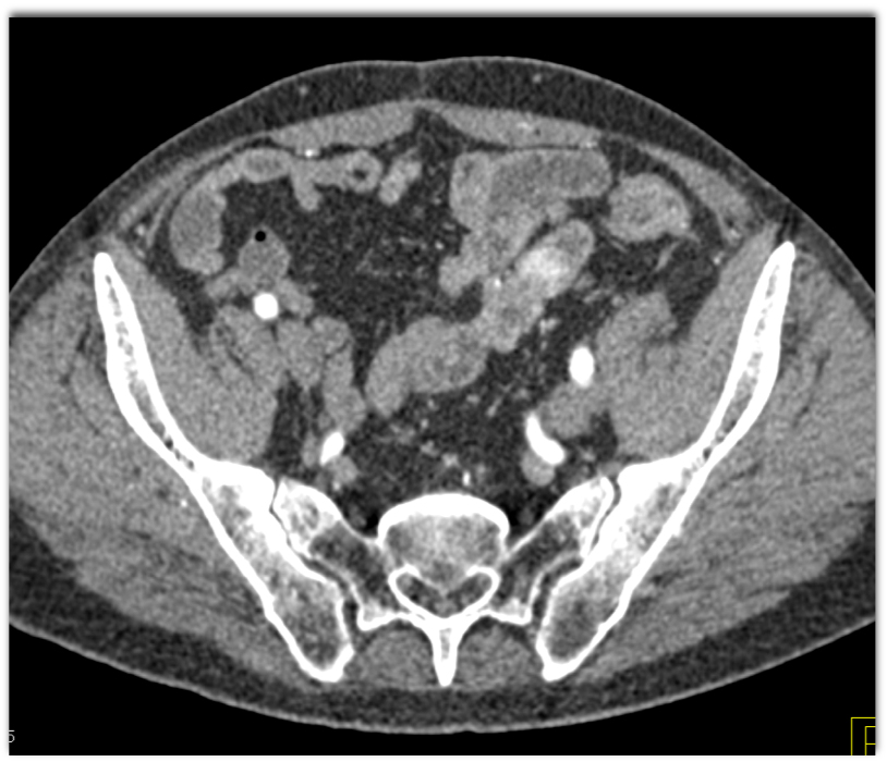 CTisus Quiz