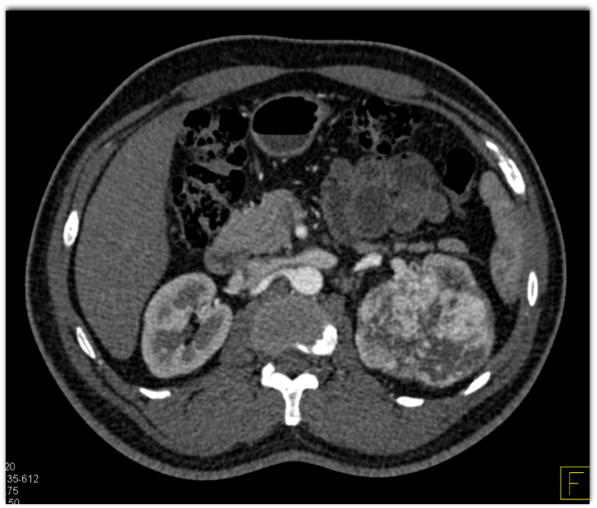 CTisus Quiz