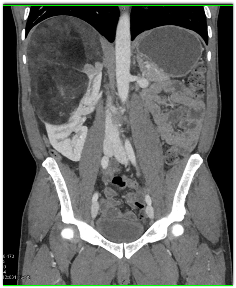 CTisus Quiz