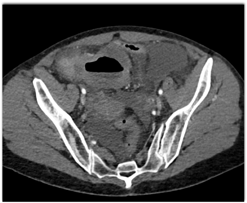 CTisus Quiz