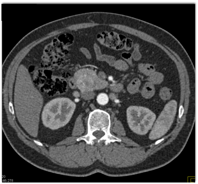 CTisus Quiz