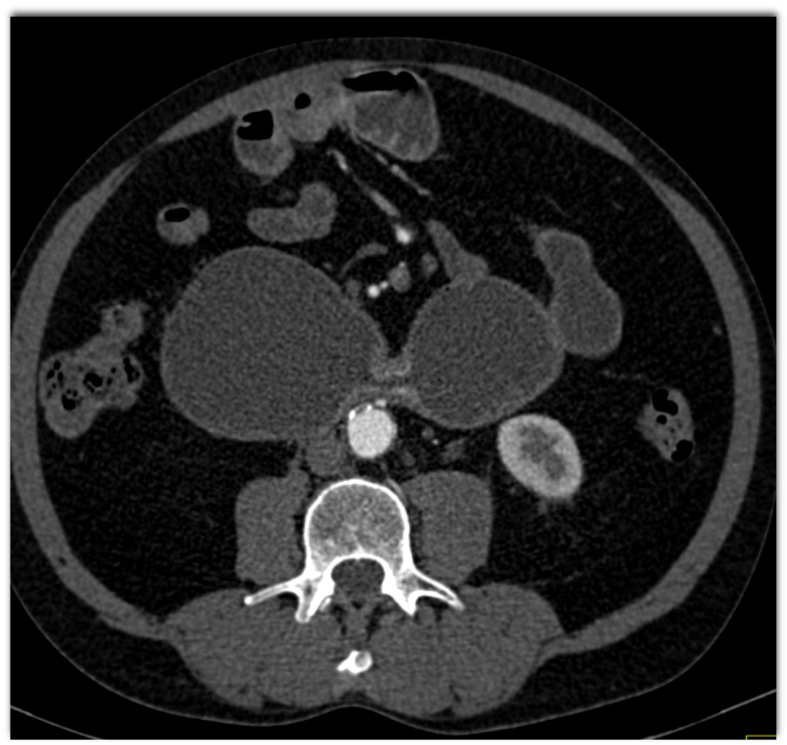 CTisus Quiz