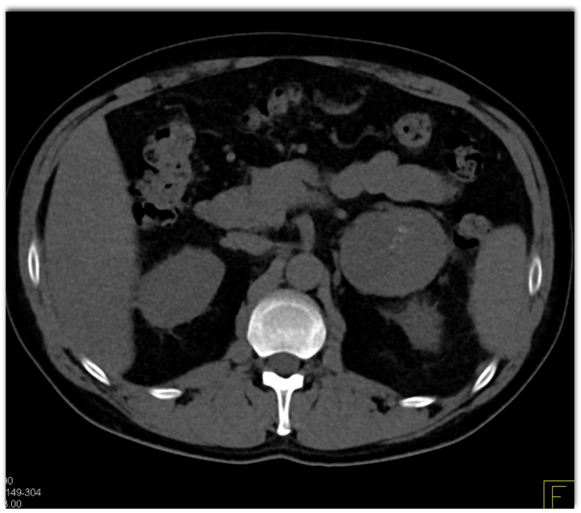 CTisus Quiz