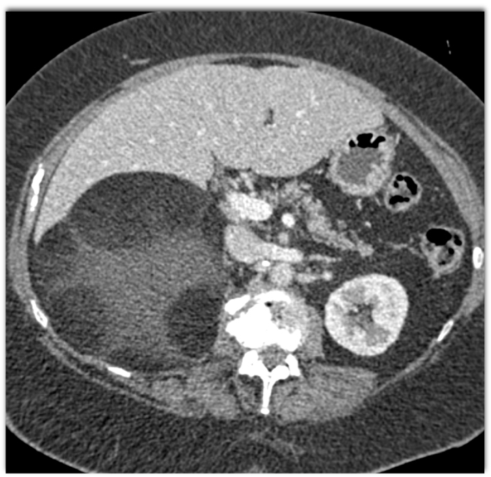 CTisus Quiz