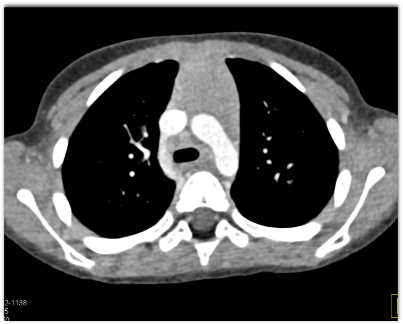 CTisus Quiz