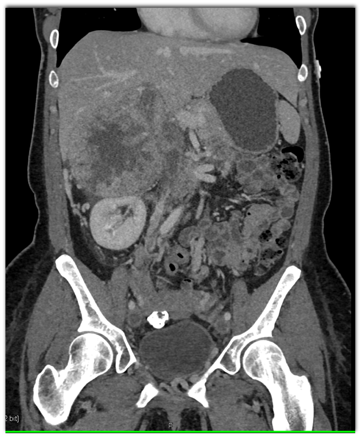 CTisus Quiz
