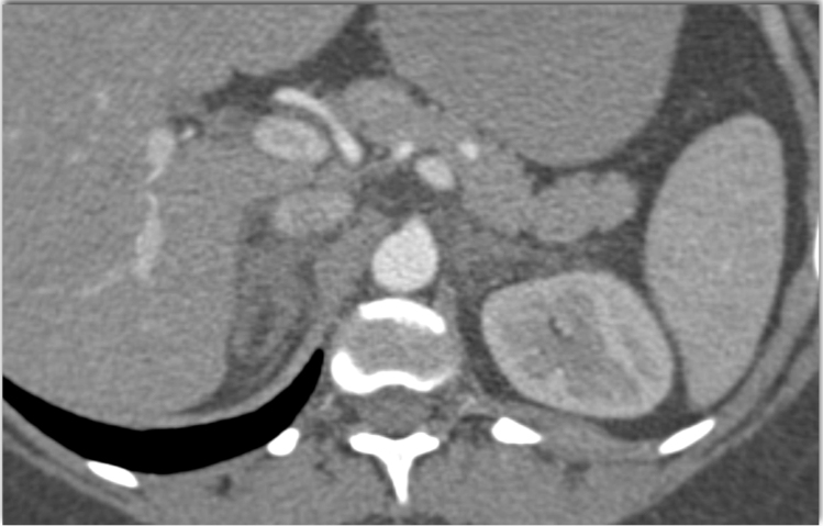 CTisus Quiz