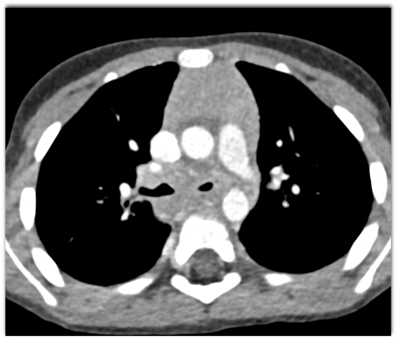 CTisus Quiz