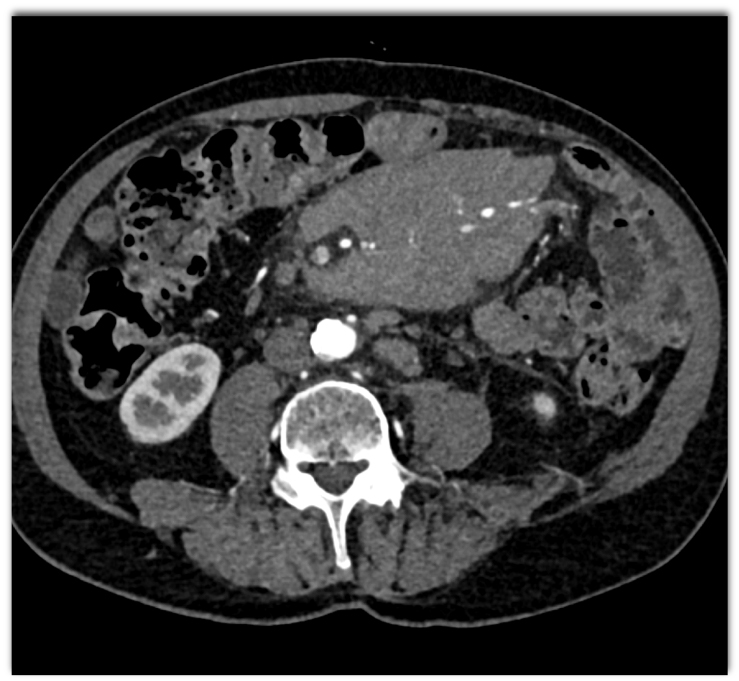 CTisus Quiz