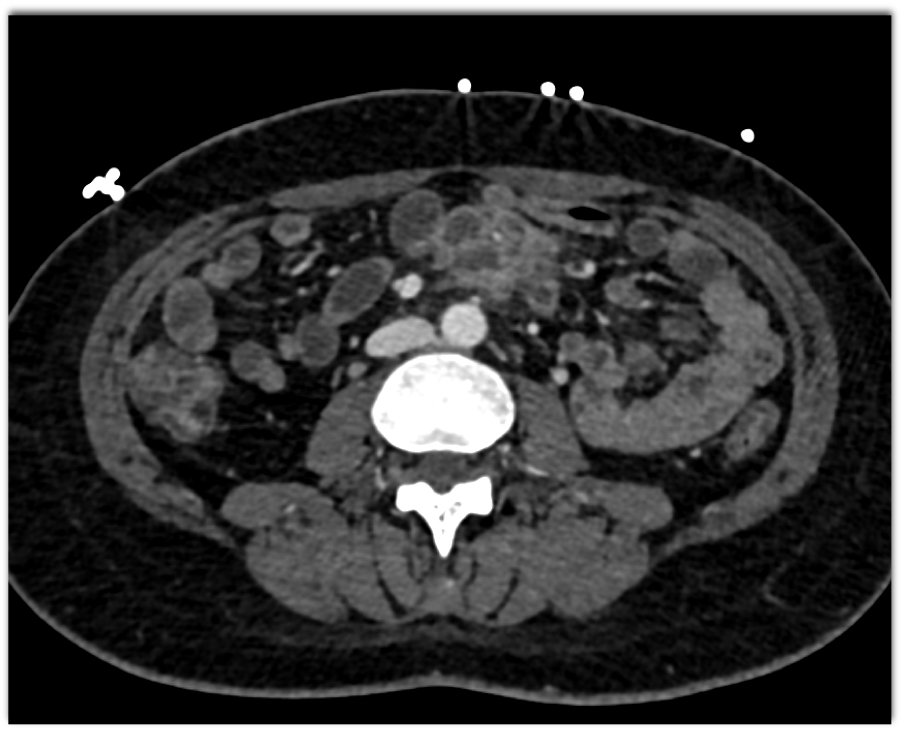 CTisus Quiz