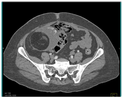 CTisus Quiz