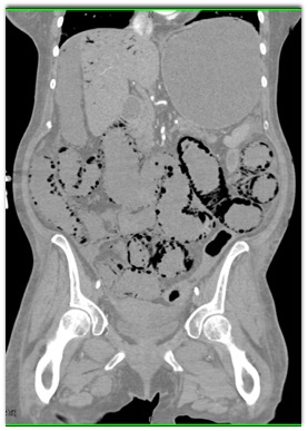 CTisus Quiz