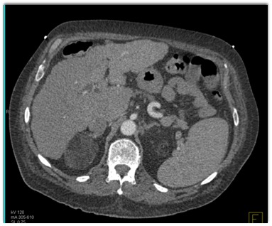 CTisus Quiz