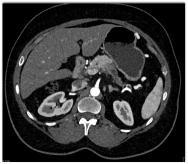 CTisus Quiz