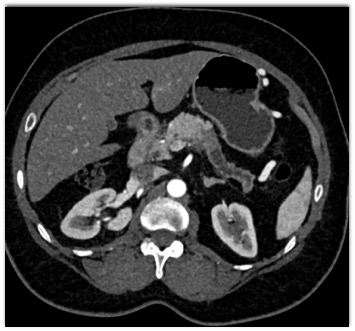 CTisus Quiz