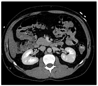 CTisus Quiz