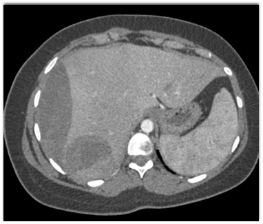 CTisus Quiz