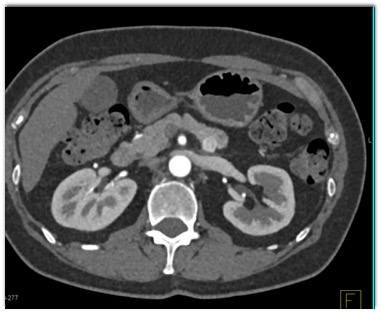 CTisus Quiz