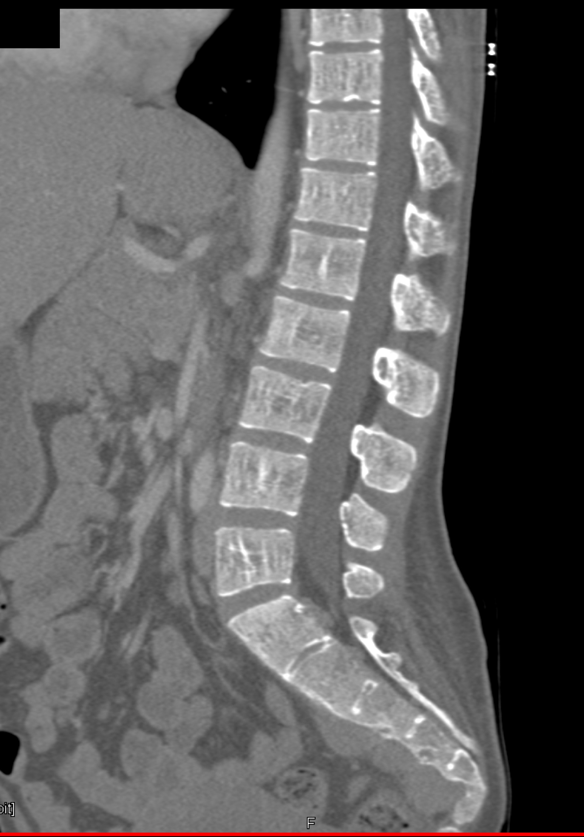 CTisus Quiz