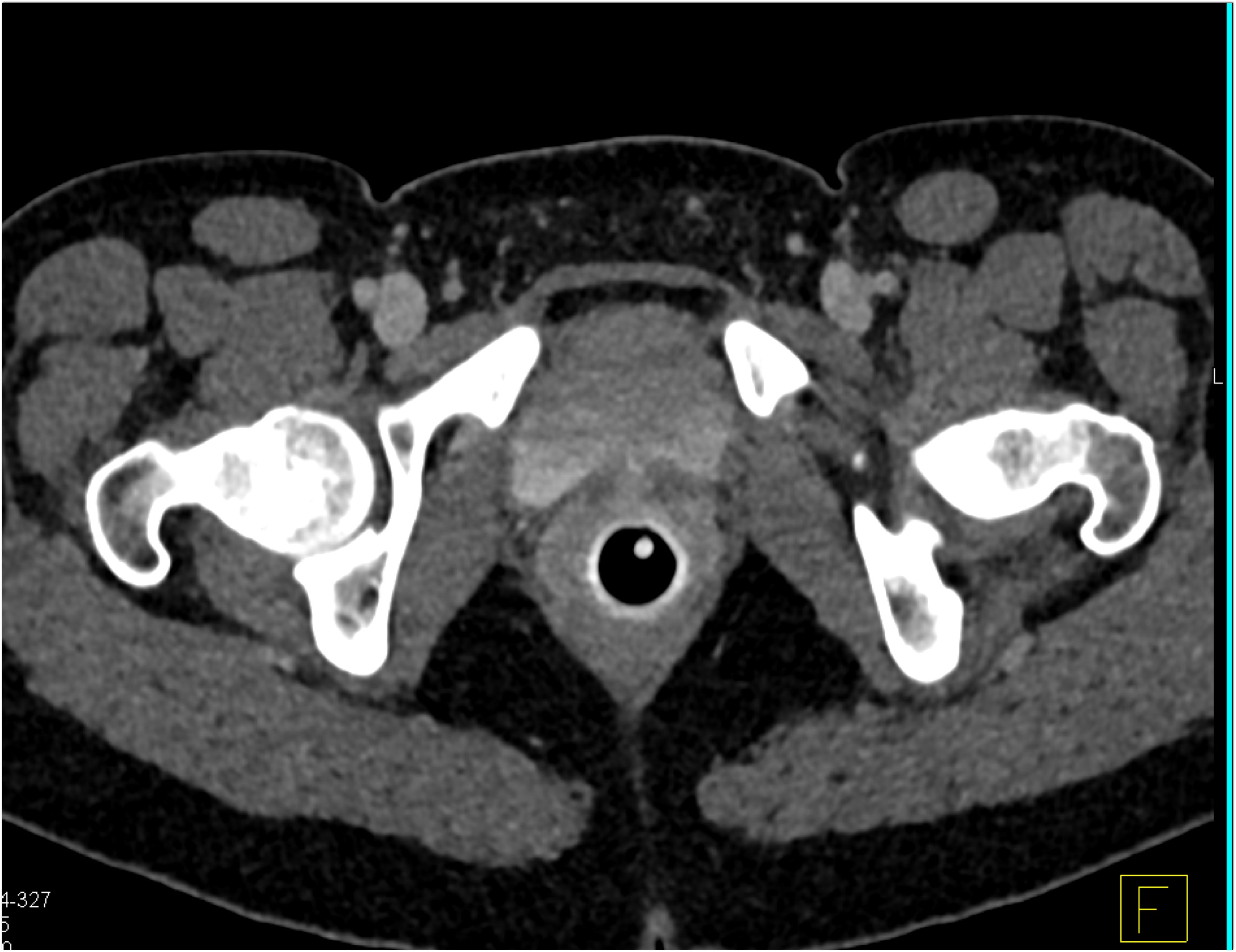 CTisus Quiz