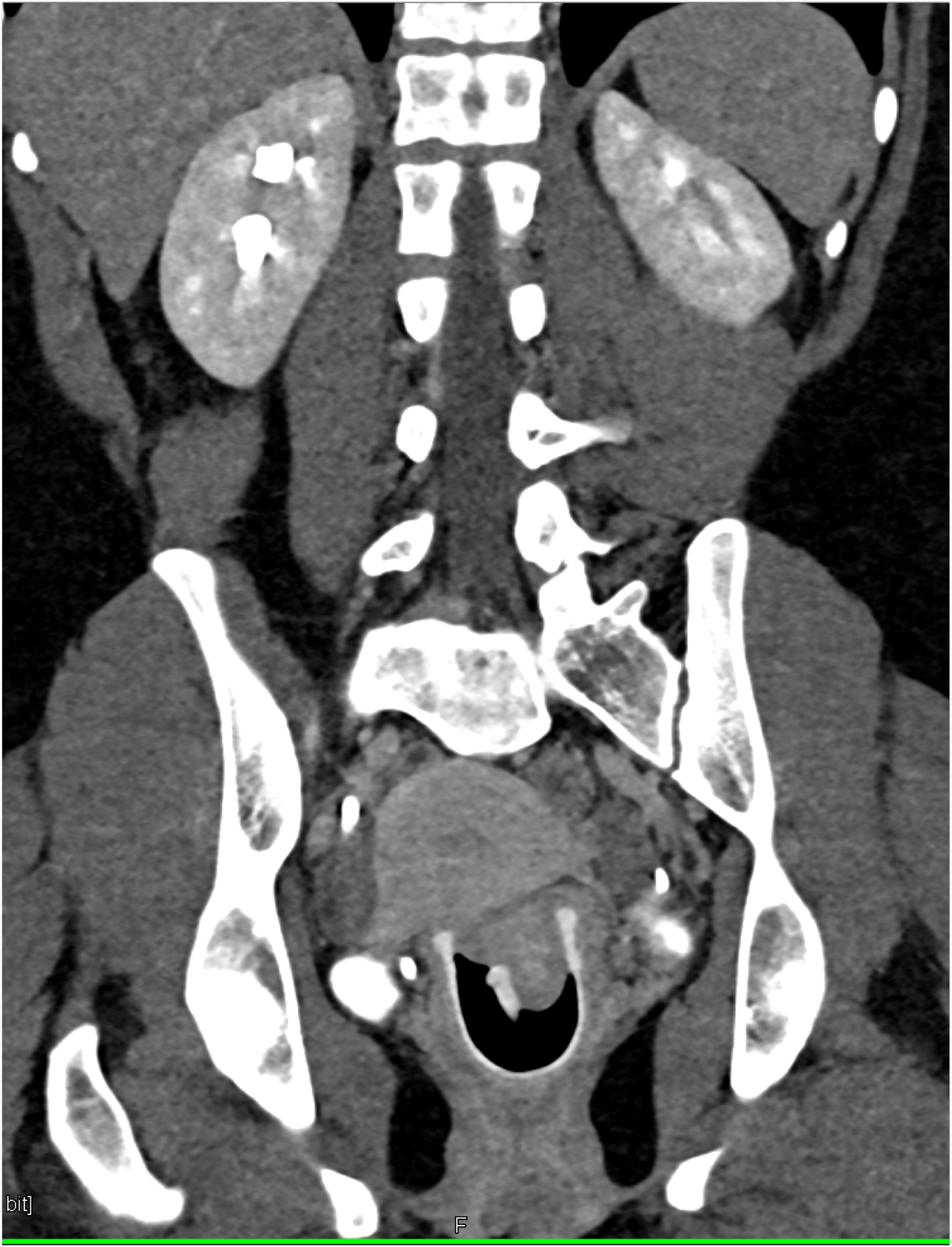CTisus Quiz