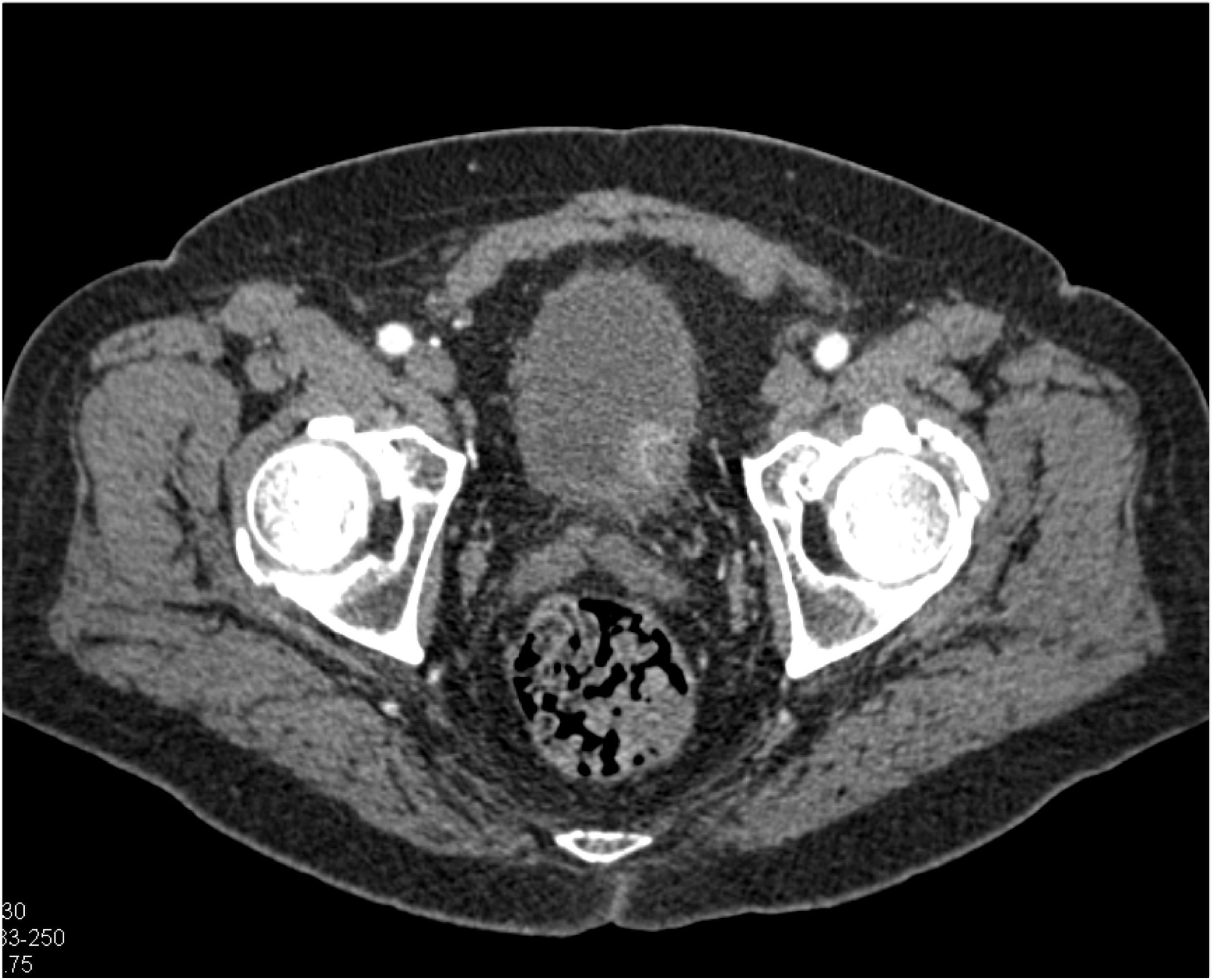 CTisus Quiz