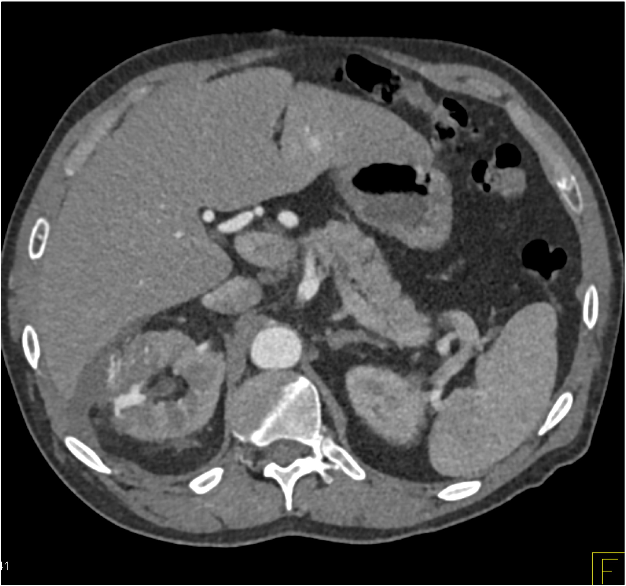 CTisus Quiz