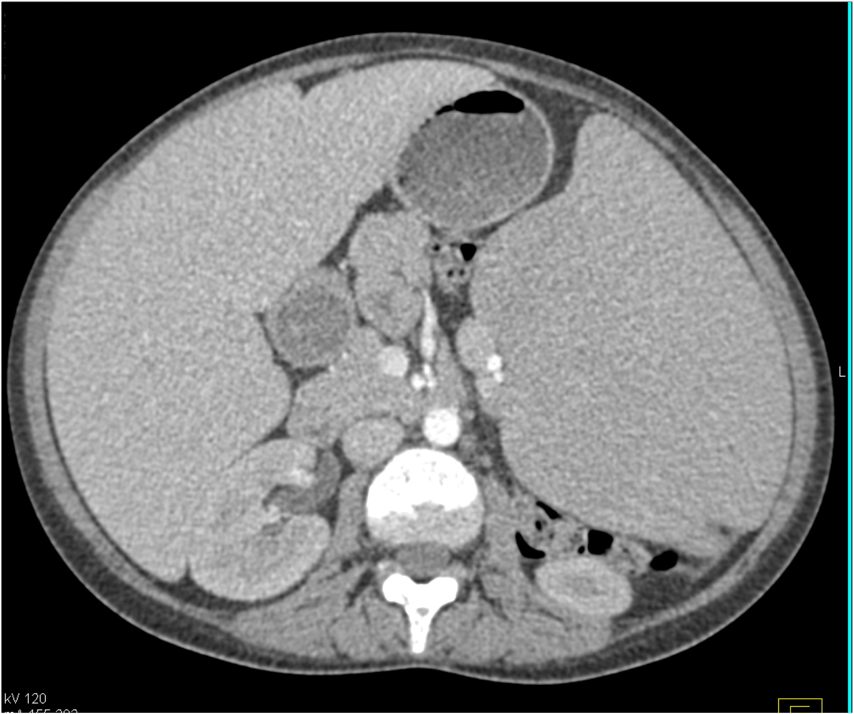 CTisus Quiz