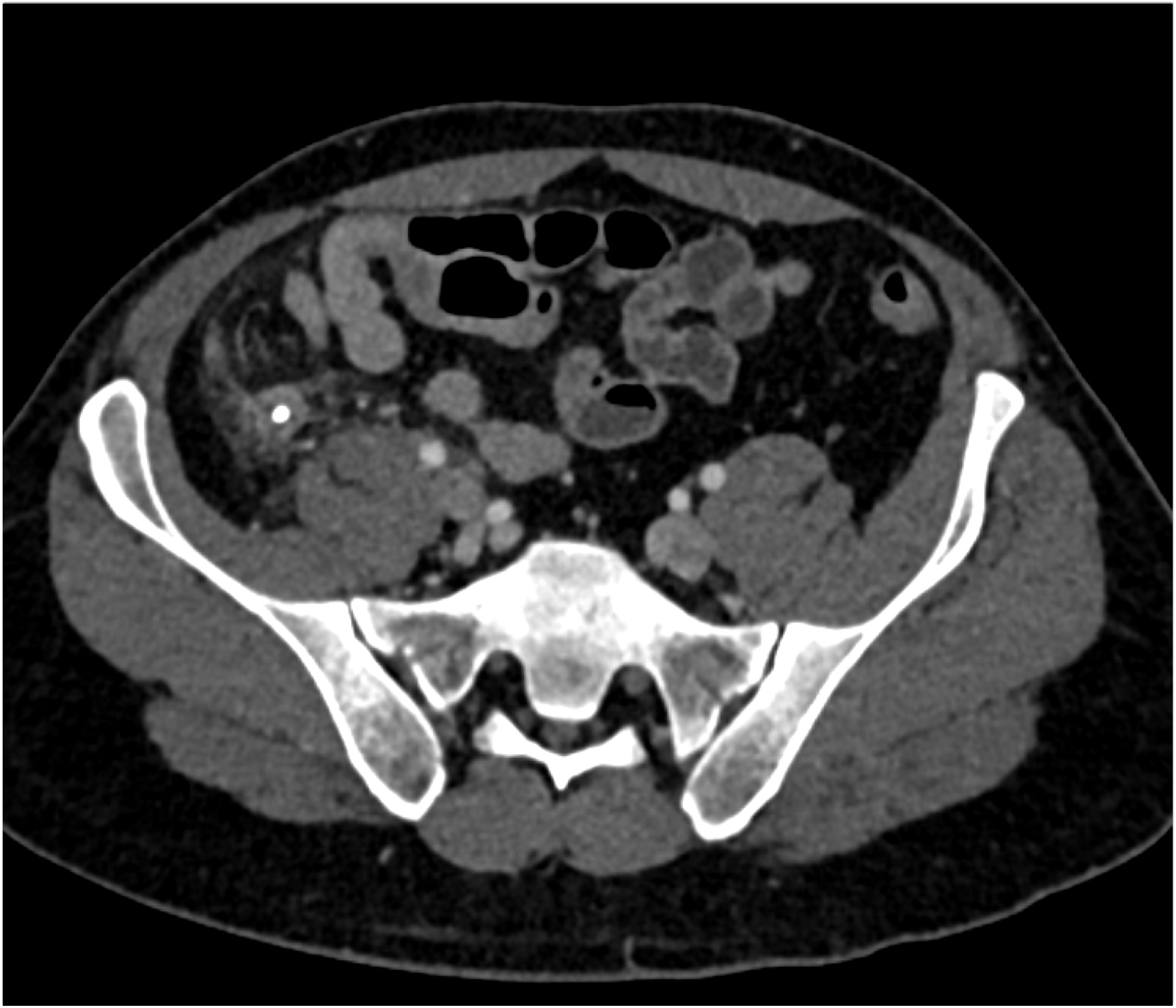 CTisus Quiz
