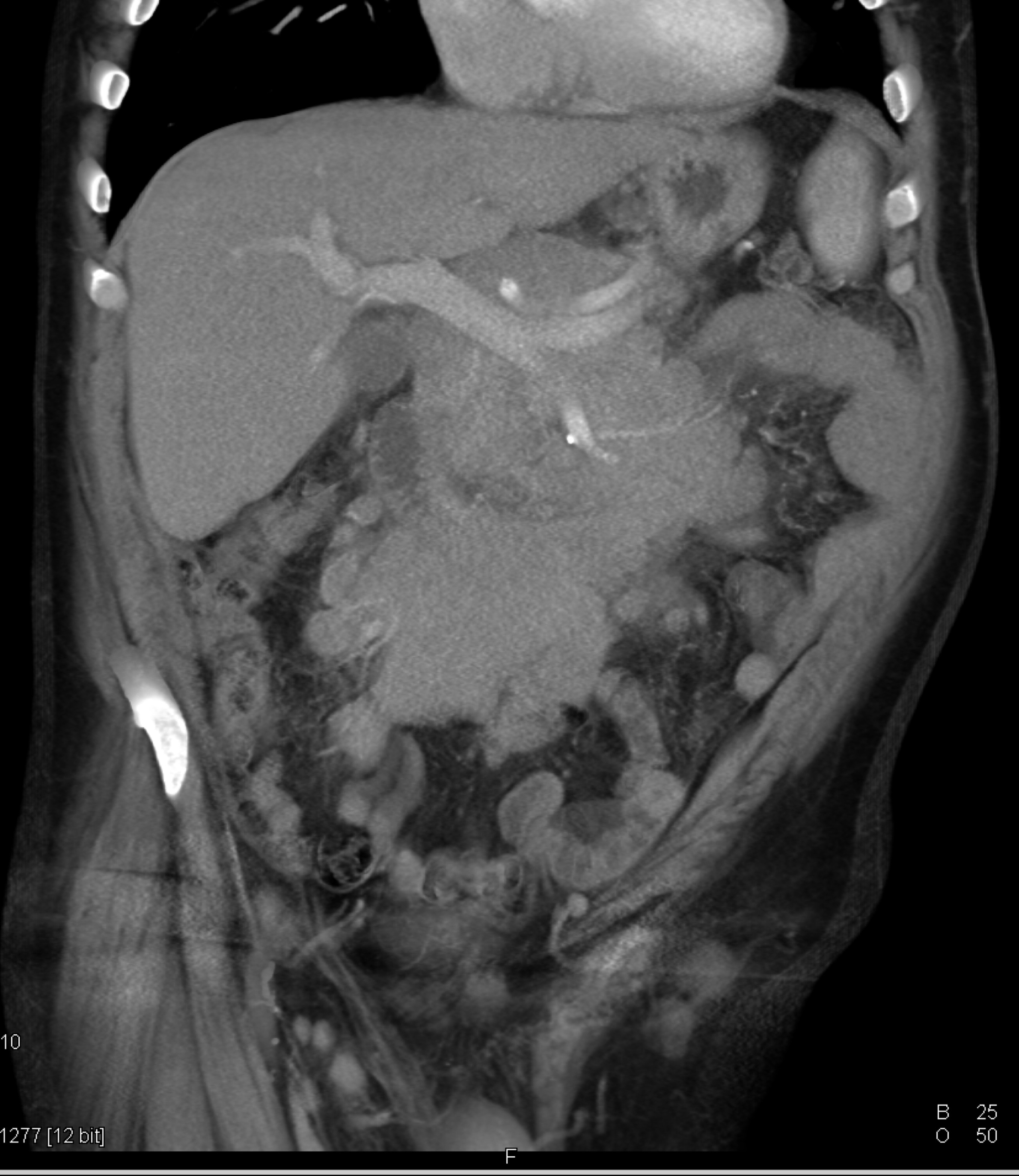CTisus Quiz