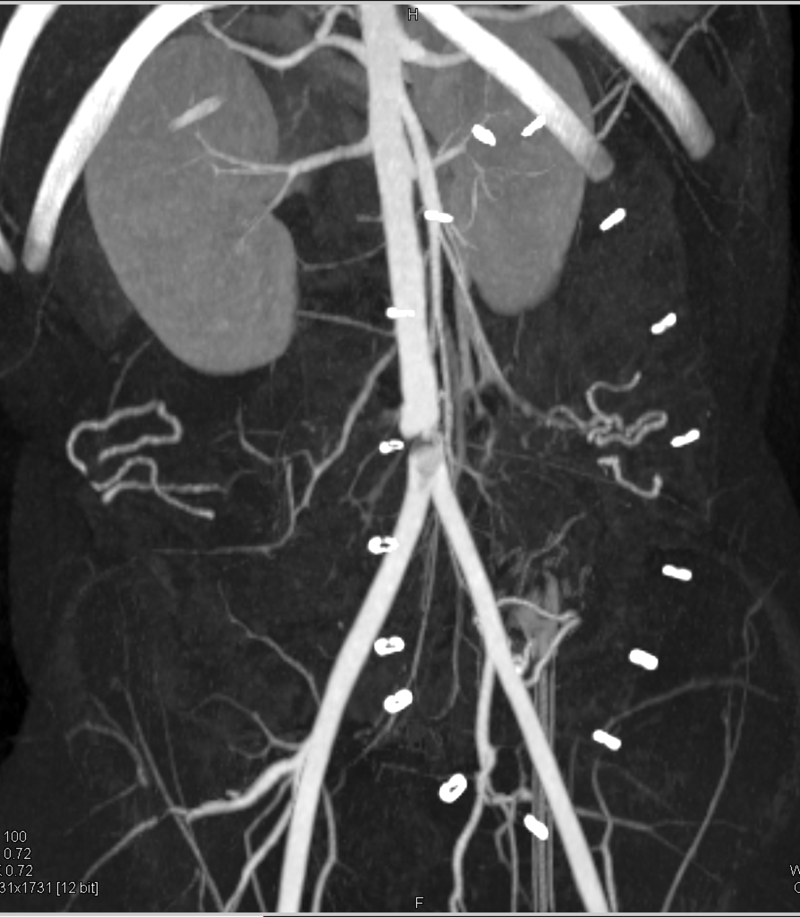 CTisus Quiz