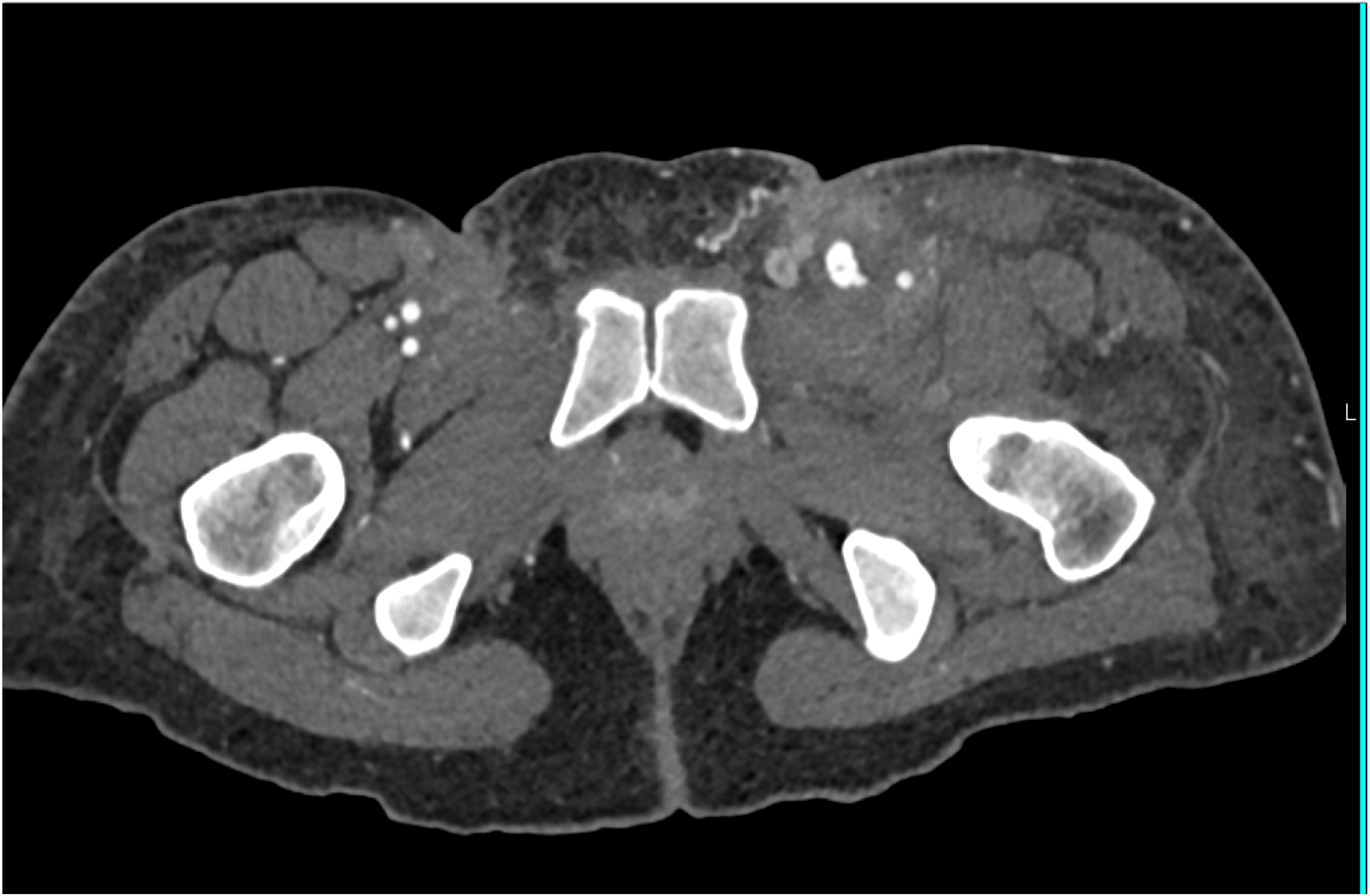 CTisus Quiz