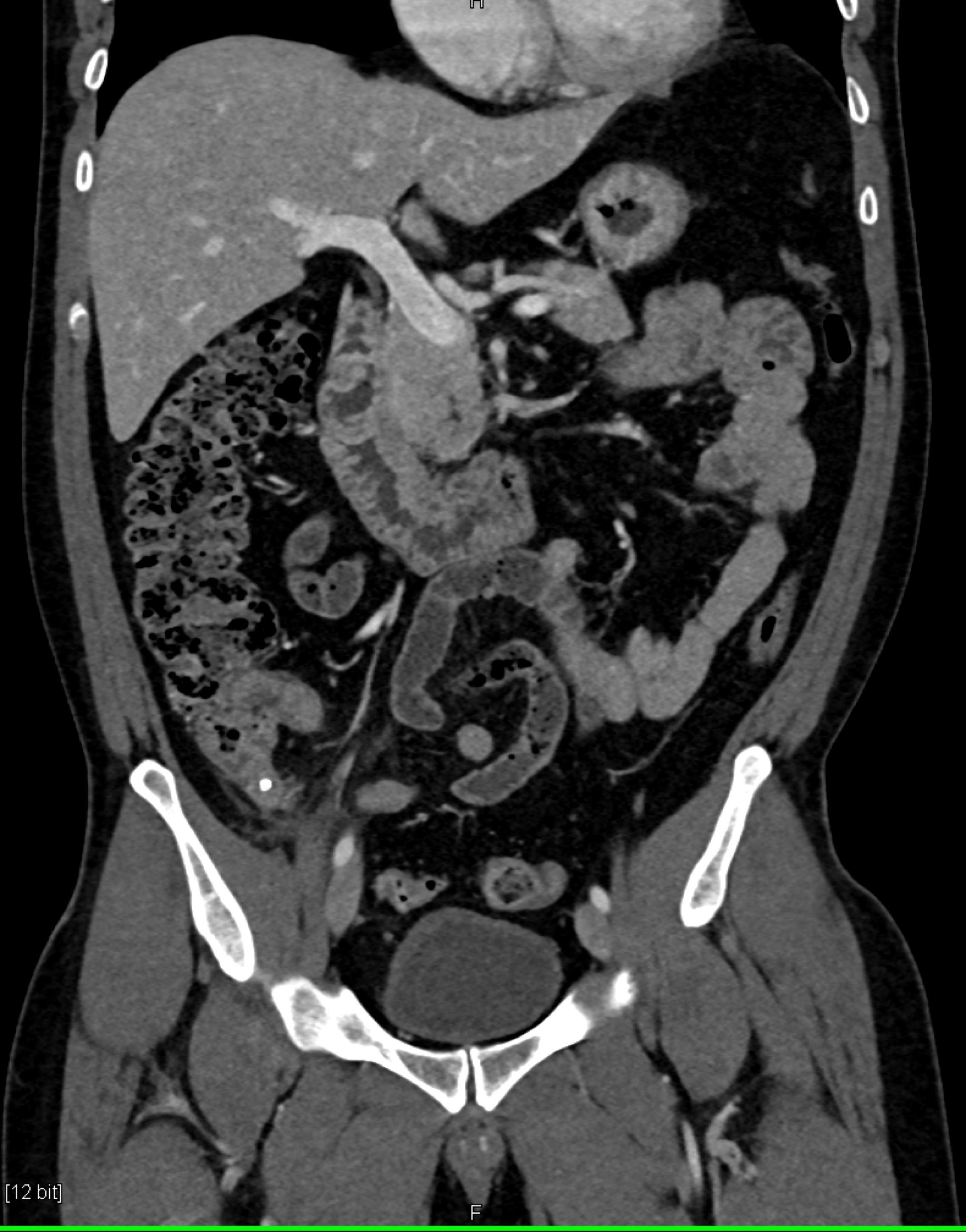 CTisus Quiz