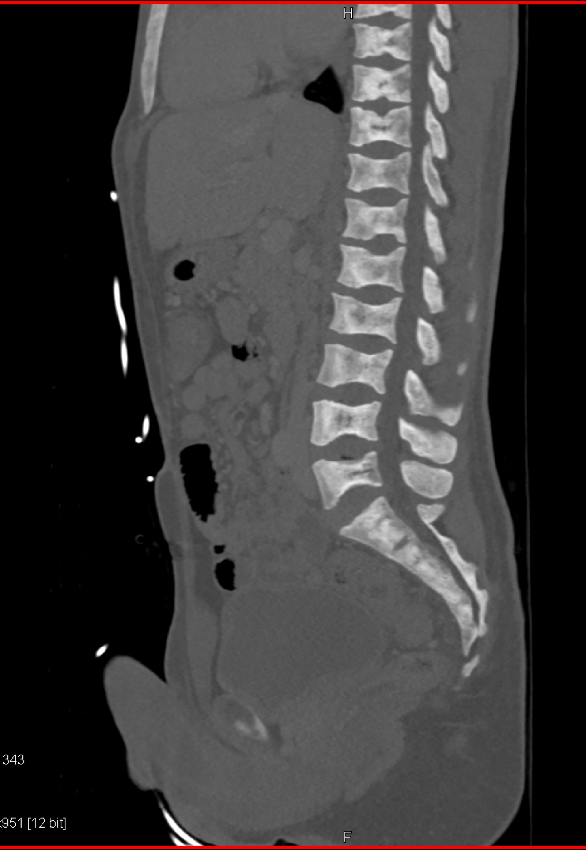 CTisus Quiz