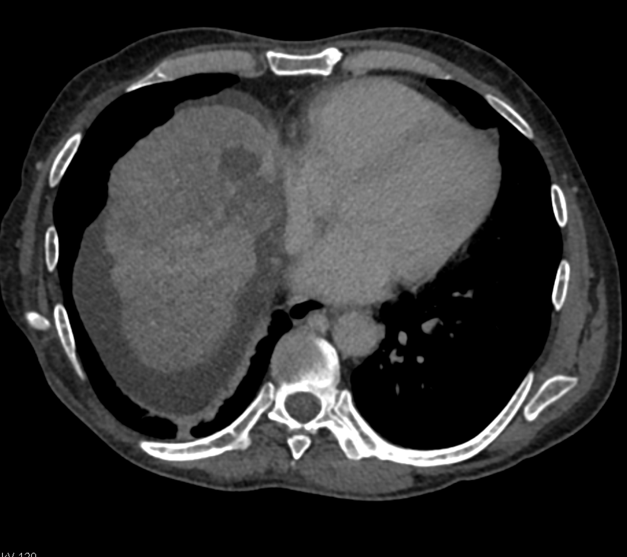 CTisus Quiz