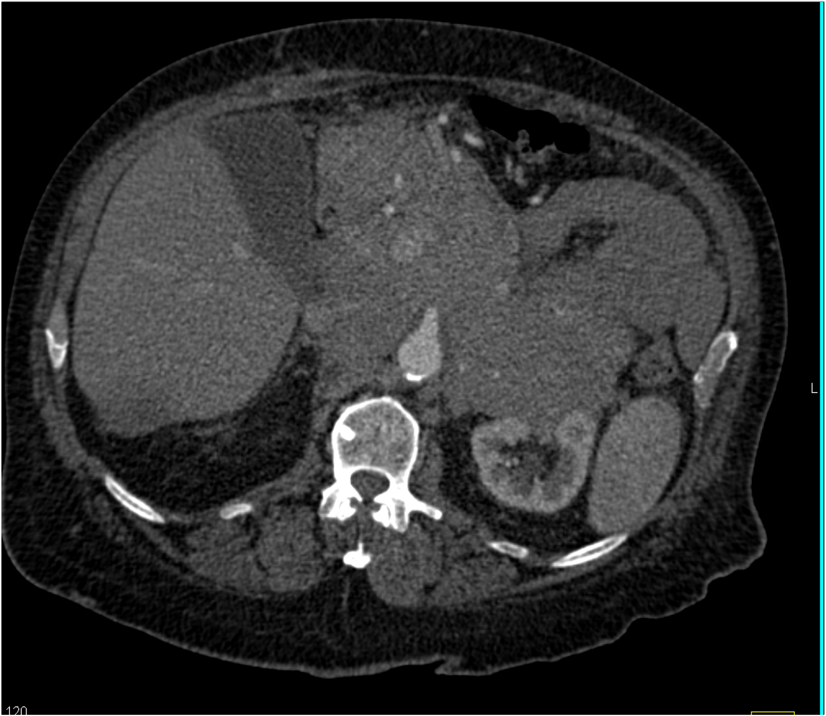 CTisus Quiz
