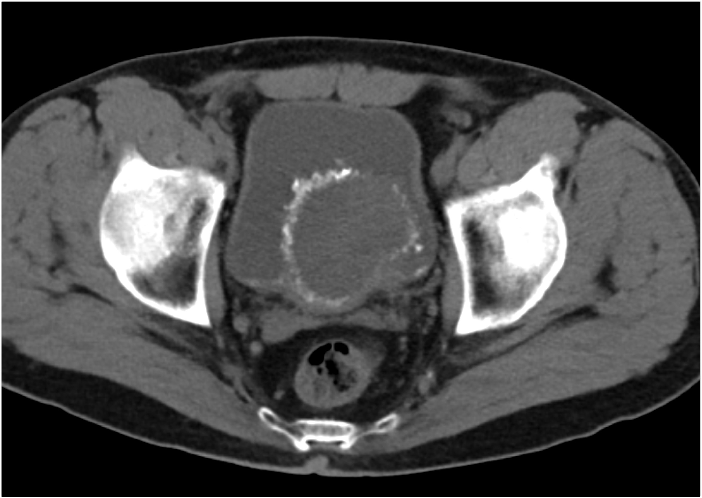 CTisus Quiz