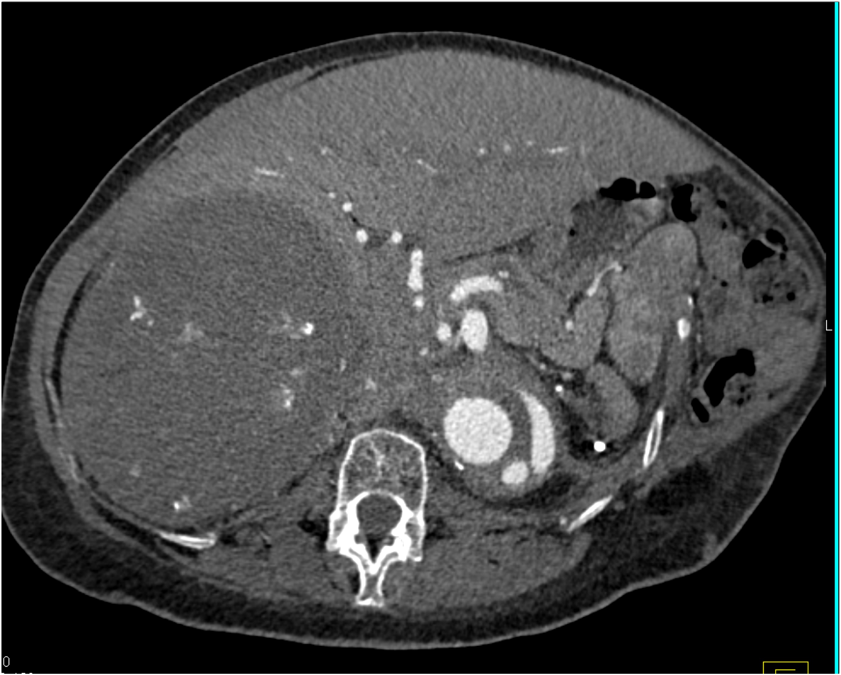 CTisus Quiz