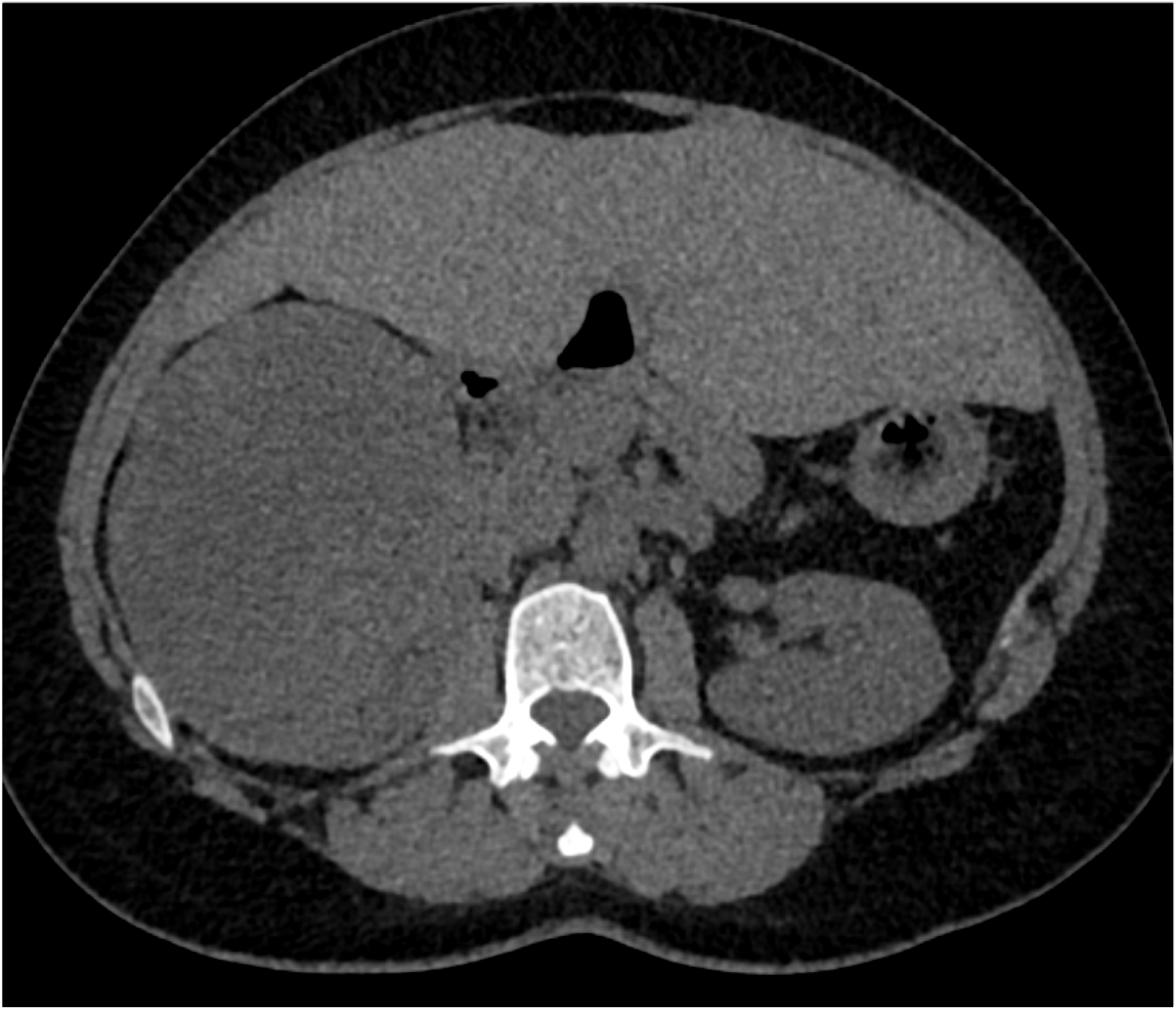 CTisus Quiz