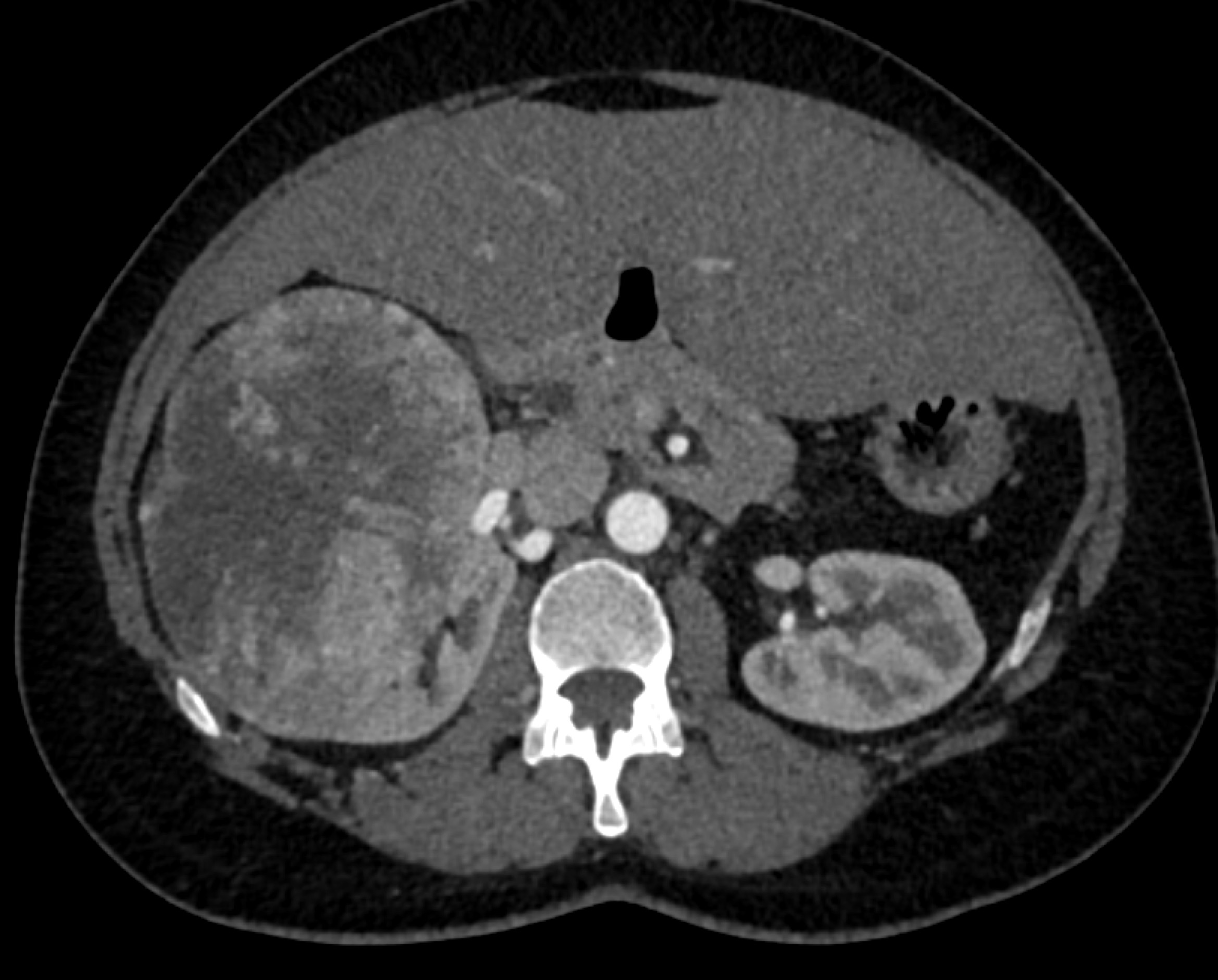 CTisus Quiz