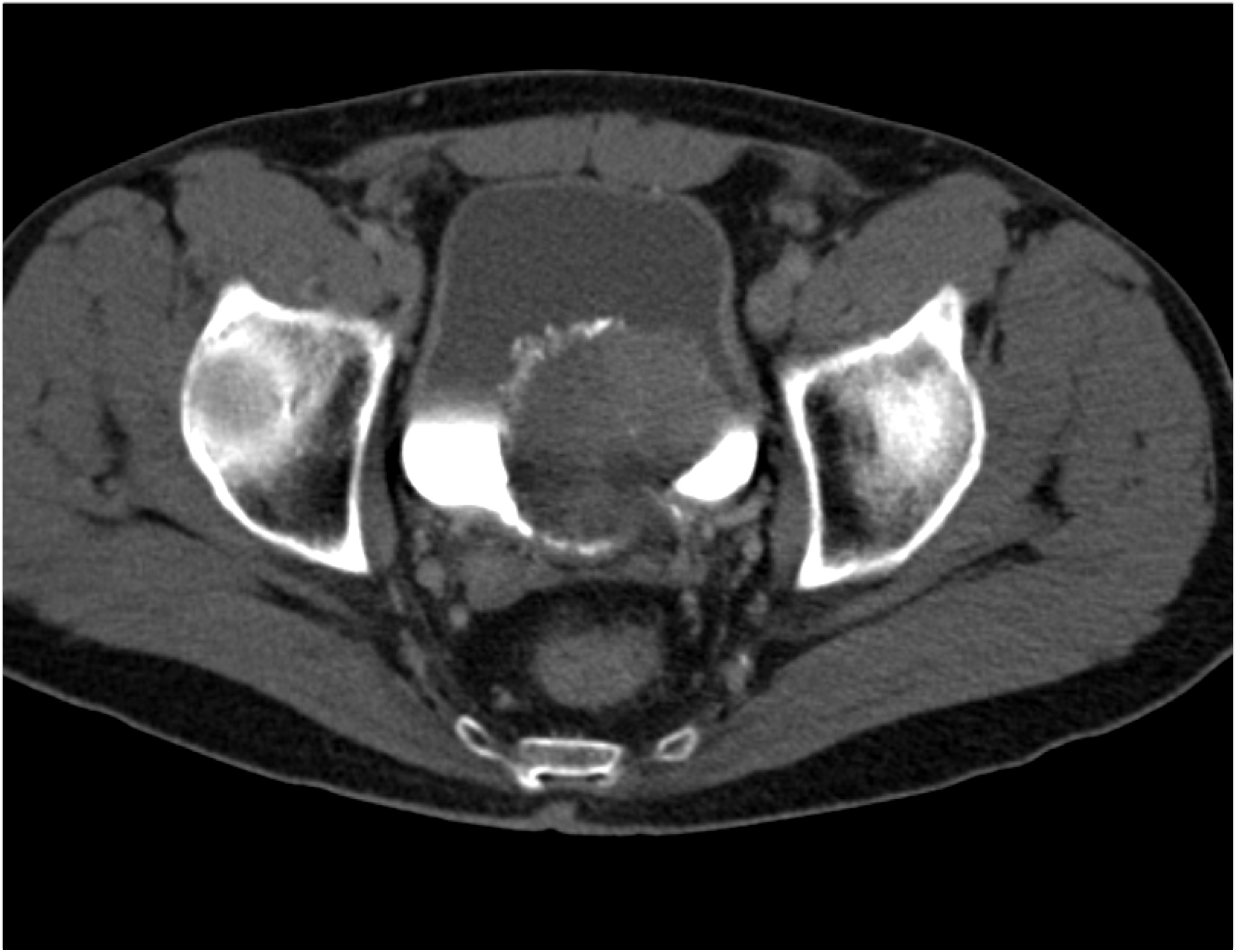 CTisus Quiz