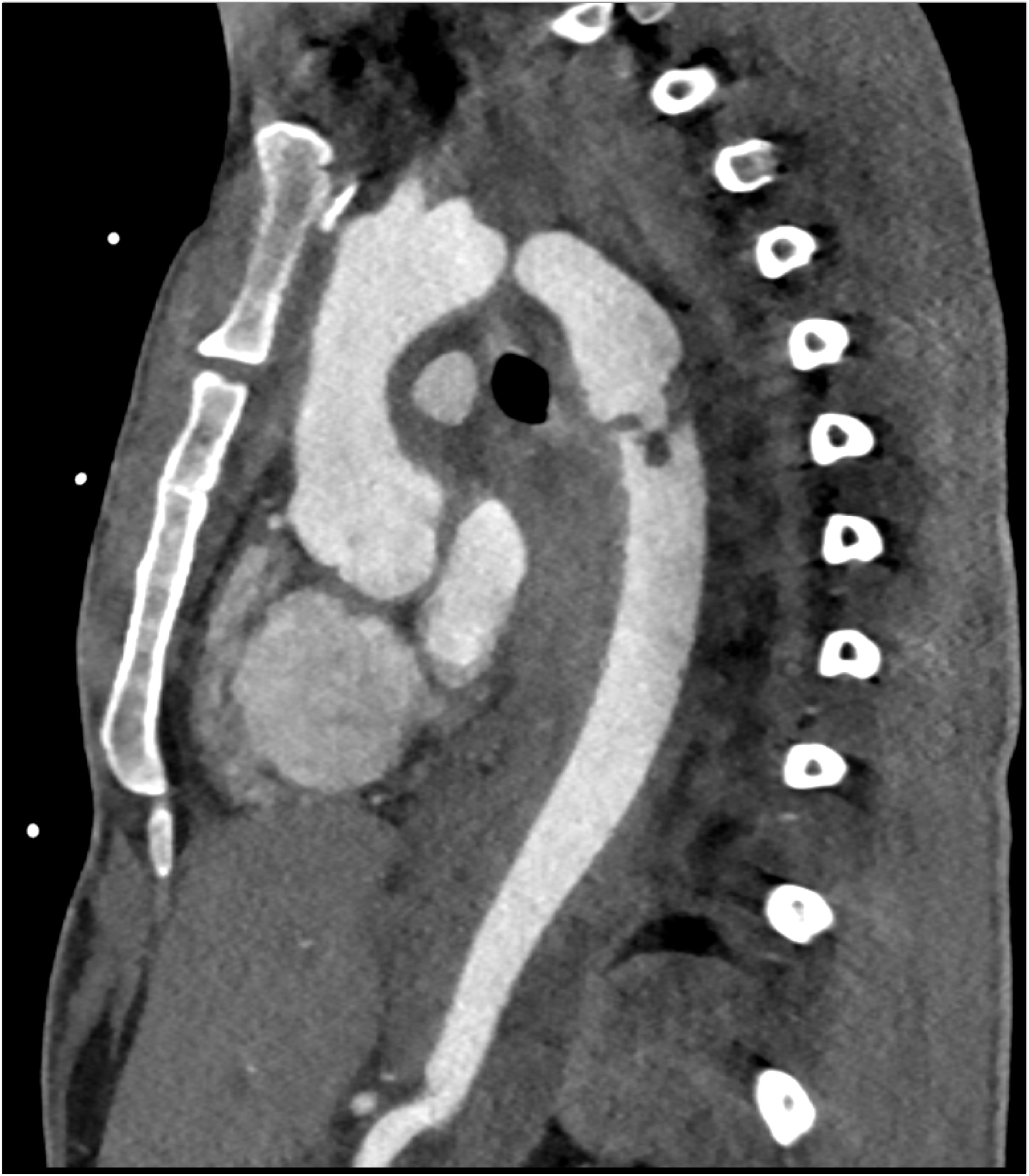 CTisus Quiz